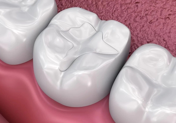 Patient Receiving Composite Fillings in Waco Dental Office